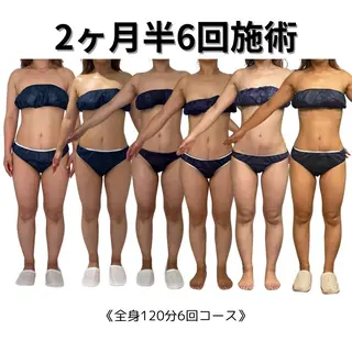 オフ:オン所属・オフ:オン 全身筋膜マッサージのエステ・リラクイメージ