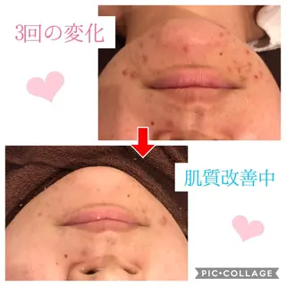 セミロング カラー パーマ ヘアアレンジ キッズ ネイル マツエク・マツパ 四つ星サロン🎖 腸＆ニキビケアに特化のエステ・リラクイメージ