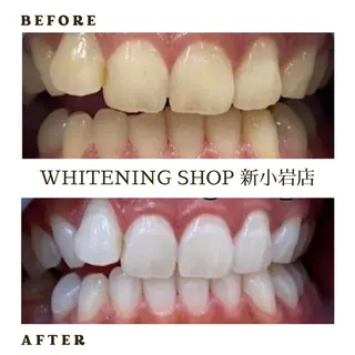 メンズ ホワイトニング ショップ新小岩店のその他イメージ