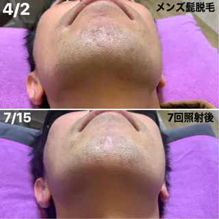 メンズ 脱毛＆エステサロン【アンリミット】所属・森谷 莉美のエステ・リラクイメージ