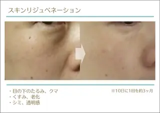 total beauty HAPPY所属・O. Minaのその他イメージ