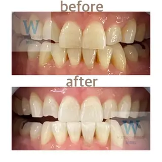 ホワイトニング ショップ船橋店🦷のエステ・リラクイメージ