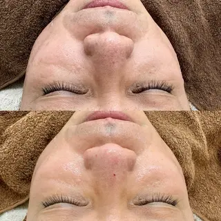 メンズ Lei beauty salon所属・松ヤニワックス専門/ 梅田/Leiのエステ・リラクイメージ