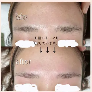 アイブロウ 脱毛サロン KiWiのエステ・リラクイメージ