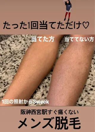 メンズ 脱毛＆エステサロン【アンリミット】所属・森谷 莉美のエステ・リラクイメージ