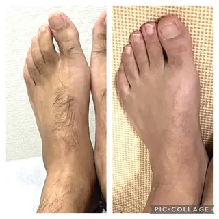 脱毛/痩身/頭皮ケア GLYCINEのエステ・リラクイメージ