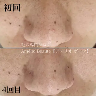 毛穴ケア専門サロン Amélio Beauté所属・毛穴ケア専門サロン アメリオボーテのその他イメージ