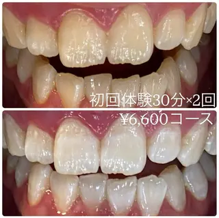 PLATINUM Beauty 横浜店所属・ホワイトニングルーム 横浜店のその他イメージ