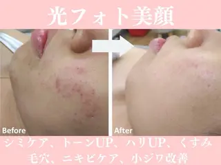 beauty SalonRcoinのマツエク・マツパデザイン