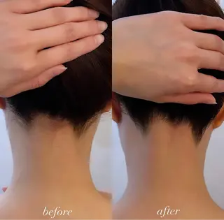 うなじ脱毛/美肌脱毛 LABELのエステ・リラクイメージ