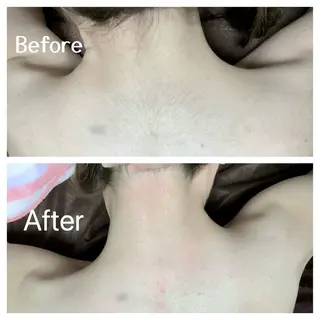 川越ローマピンク 光脱毛＆ワックス脱毛のエステ・リラクイメージ