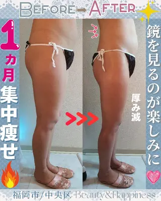 痩身ハーブピーリング 筋膜リリース☆B&Hのエステ・リラクイメージ