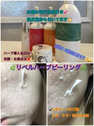 【リベルハーブピーリング認定店】敏感肌・美白脱毛専門店Dione立川店所属・Dione 立川店のエステ・リラクイメージ