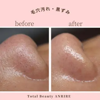 ANRIRE (アンリール)のエステ・リラクイメージ