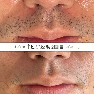 メンズ SKIN GYM所属・SKIN GYM メンズ専門脱毛サロンのエステ・リラクイメージ