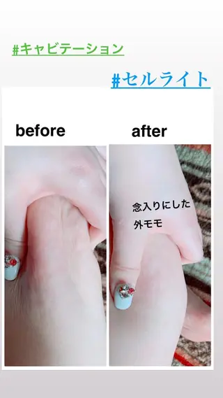 痩身/脱毛/ネイル HARUKAのエステ・リラクイメージ