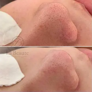 Mignon +所属・Mignon + Natsukiのマツエク・マツパデザイン