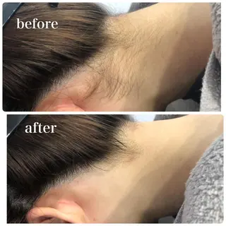 美肌脱毛・ハーブピーリング専門店Larin la beaute所属・Larin la beauteのエステ・リラクイメージ