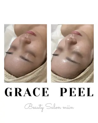 韓国肌管理 白玉肌管理®︎のエステ・リラクイメージ