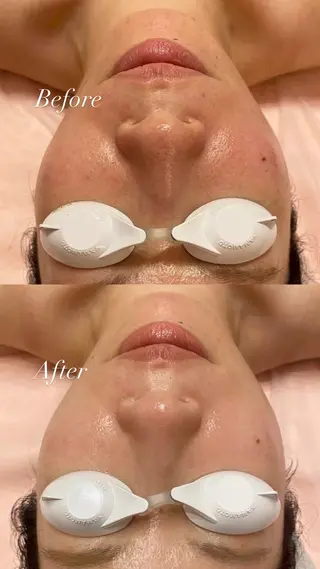 SAERA yuyuのエステ・リラクイメージ