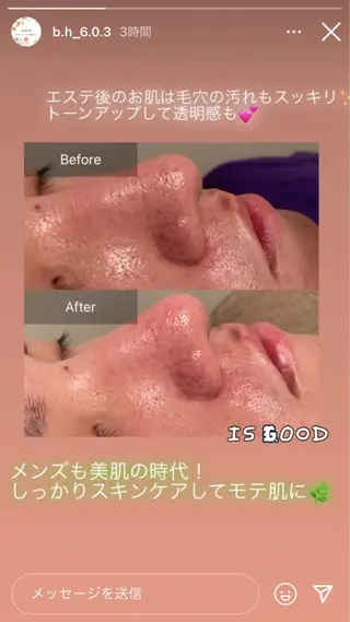 メンズ Ｂ&H所属・頭痛•肩こり専門/ 眉サロンB&H心斎橋のエステ・リラクイメージ