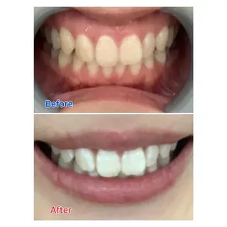 MBEAUTYSALON 千葉店・京成大久保所属・Melty 輝のその他イメージ