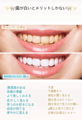 ホワイトニングサロンLuana-Sinfonia(エクシア)池袋店所属・セルフホワイトニング エクシア 池袋店のその他イメージ