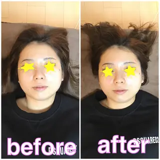 メンズ TOTAL BODY CARE SALON SUNNY所属・整体小顔･筋膜オイル ブライダルエステのエステ・リラクイメージ