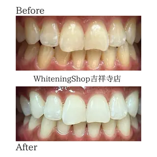 ホワイトニング ショップ吉祥寺店のエステ・リラクイメージ