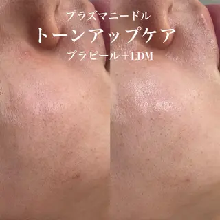 韓国肌管理&小顔 ＩＲＯＨＡのエステ・リラクイメージ