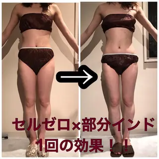 Cielo(シエロ) ダイエット専門店のエステ・リラクイメージ