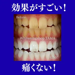 ホワイトニング ショップ多摩店のその他イメージ