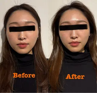 鍼灸サロン mahorobaトモのエステ・リラクイメージ