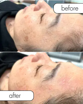 hug me. シュガーリングサロンのエステ・リラクイメージ