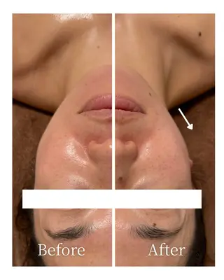 Lani Moon所属・⟡ 京都 小顔  ⊹ Lani Moonのエステ・リラクイメージ