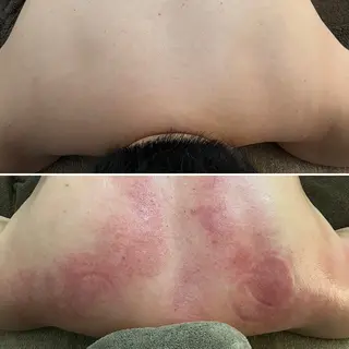 hitomi バストケアサロンのエステ・リラクイメージ