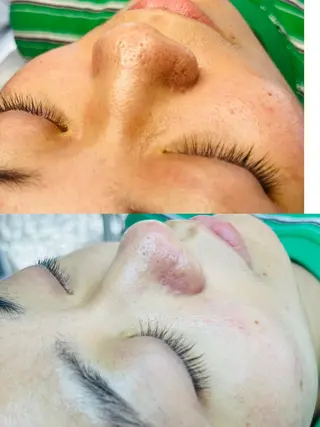 Beauty Zion所属・Beauty Zionのエステ・リラクイメージ