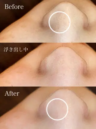 EARTH coiffure beaute 新潟紫竹山店所属・🤍アベシュリ /フェイシャル🤍のエステ・リラクイメージ