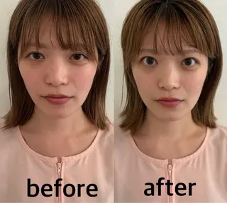 美容鍼灸サロン mahoroba院長のエステ・リラクイメージ