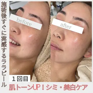 RIM total beautyのネイルデザイン