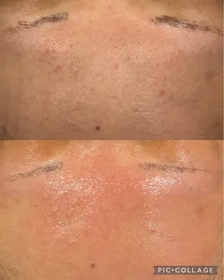 インディバサロン　ソレイユ所属・indiba soleilのエステ・リラクイメージ