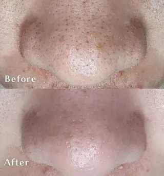 Iryアイリー所属・Iry アイリーのエステ・リラクイメージ