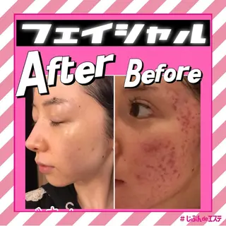 じぶんdeエステ 名古屋PARCO店所属・名古屋パルコ店 じぶんdeエステのエステ・リラクイメージ