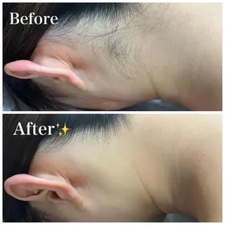 脱毛サロン fam.豊澤柚良のエステ・リラクイメージ