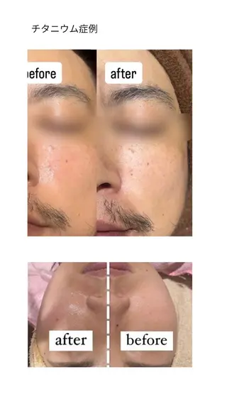 秒速小顔所属・秒速小顔 岩邊のその他イメージ