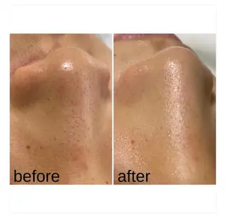 【頭痛、睡眠改善】 salon RUUのエステ・リラクイメージ