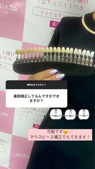 エクシアホワイトニング草津店所属・nanami -ホワイトニングのその他イメージ