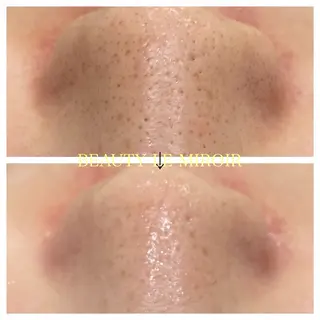 ビューティー ミロワールのエステ・リラクイメージ