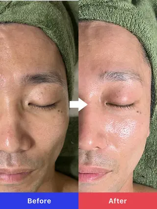 メンズ 【肌質改善サロン】 リーフィアのエステ・リラクイメージ