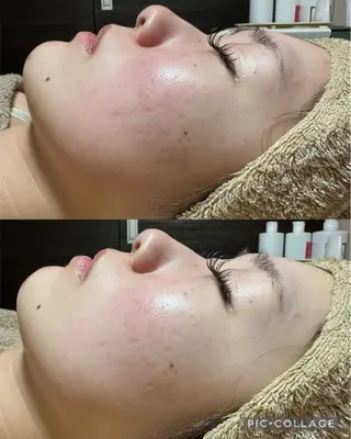 エステ✖️ネイル Feelのネイルデザイン